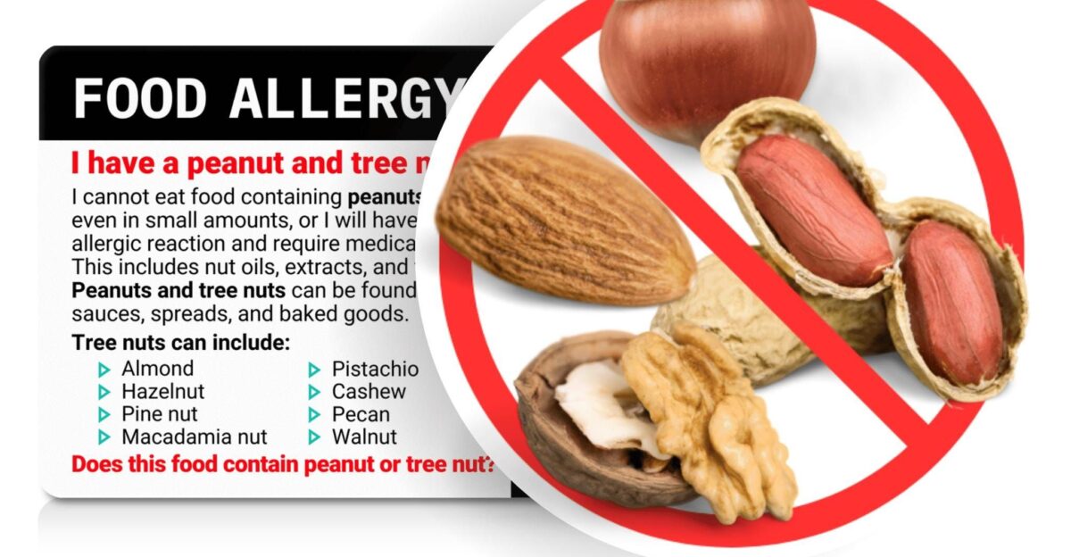 Peanut and Tree Nut Allergy Translation Card Select from 50 Languages Plastic Card Allergy Alert Card Pro Translations Equal Eats by Etsy