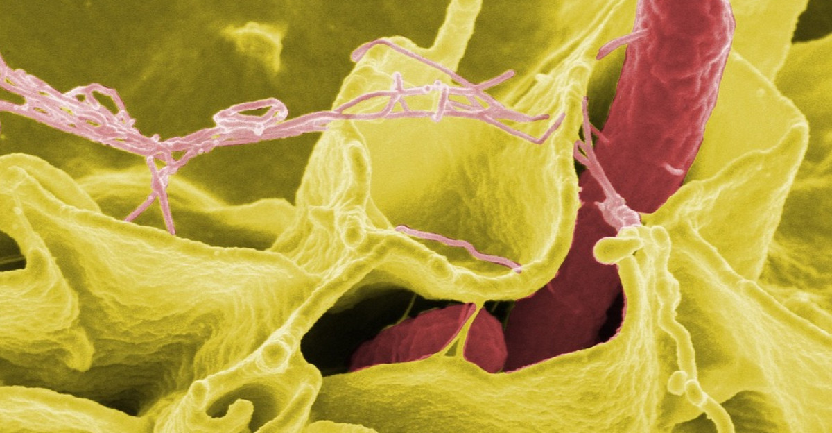 bacteria salmonella pathogens disease electron microscopy electron micrograph science magnification coliform enterobacteriaceae escherichia infection infect infected danger contagious risk of infection vaccination bacteria bacteria bacteria bacteria bacteria salmonella salmonella salmonella